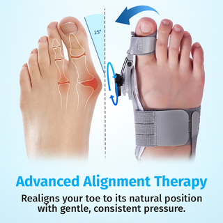 ORNEXIS - BUNION FIX TOE PAIN FROM HOME