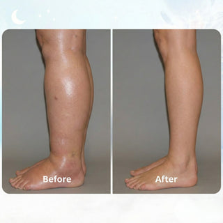 ORNEXIS - EMS FIX SWOLLEN LEGS FROM HOME